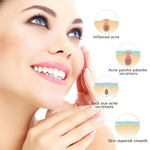 Smooth Skin - Pukkel Removers - Shopbrands