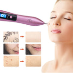 SkinPerfect™ - Plasma Pen Vlekken Verwijderaar - Shopbrands